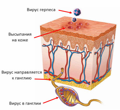 герпес в нервных клетках