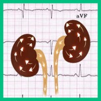 Диуретики при гипертонии
