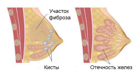 Мастофитон и мастофит в чем разница. Смотреть фото Мастофитон и мастофит в чем разница. Смотреть картинку Мастофитон и мастофит в чем разница. Картинка про Мастофитон и мастофит в чем разница. Фото Мастофитон и мастофит в чем разница